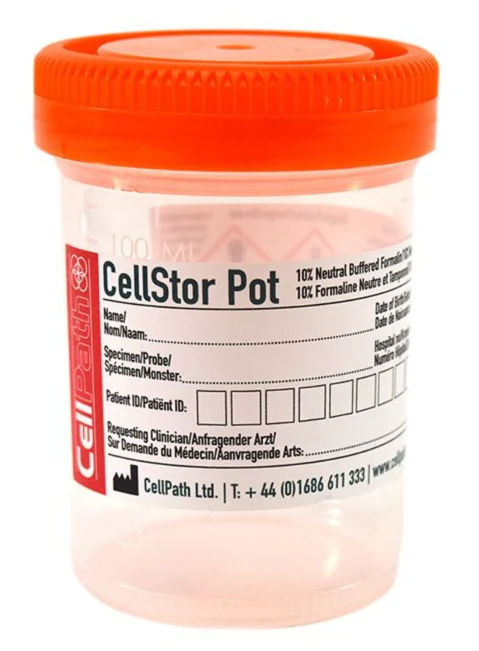 Pre-filled Formalin Specimen Jars